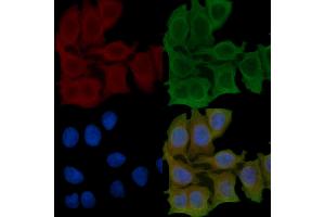 ABIN6257067 and ABIN6275524 staining Hela cells(45 min of heat-shock) by IF/ICC. (Septin 7 抗体  (C-Term))