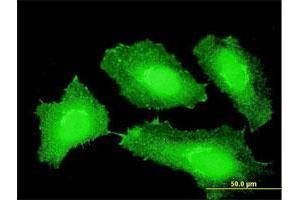 Immunofluorescence of monoclonal antibody to CTNNB1 on HeLa cell. (CTNNB1 抗体  (AA 682-781))