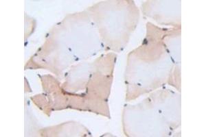 Used in DAB staining on fromalin fixed paraffin- embedded Kidney tissue (Myogenin 抗体  (AA 4-219))