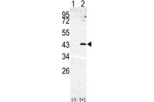 Western Blotting (WB) image for anti-Signal Peptide Peptidase 3 (SPPL3) antibody (ABIN3002611) (SPPL3 抗体)
