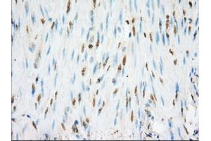 Immunohistochemical staining of paraffin-embedded colon tissue using anti-NME4 mouse monoclonal antibody. (NME4 抗体)