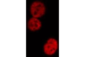 ABIN6274181 staining HeLa cells by IF/ICC. (UBTF 抗体  (Internal Region))