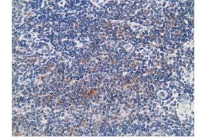 Image no. 5 for anti-Protein Kinase, CAMP-Dependent, Regulatory, Type I, beta (PRKAR1B) antibody (ABIN1500406)