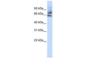MCTP1 antibody used at 1 ug/ml to detect target protein. (MCTP1 抗体  (Middle Region))