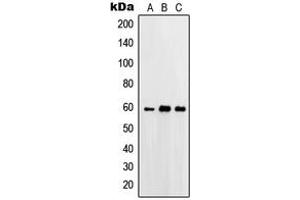 Western blot analysis of Beta-glucosidase 2 expression in A431 (A), HeLa (B), A549 (C) whole cell lysates.