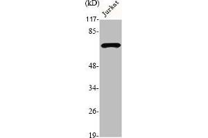 Western Blot analysis of Jurkat cells using DMPK Polyclonal Antibody (DMPK 抗体  (N-Term))