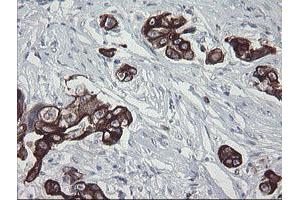 Image no. 12 for anti-Src-like-adaptor 2 (SLA2) antibody (ABIN1500949)
