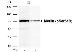 Western blot analysis of extracts from C6 cells, treated with calf intestinal phosphatase (CIP), using Merlin (Phospho-Ser518) Antibody.