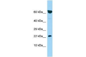 Host: Rabbit Target Name: PBOV1 Sample Type: 721_B Whole Cell lysates Antibody Dilution: 1. (PBOV1 抗体  (N-Term))