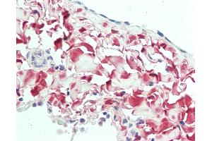 Anti-Osteoglycin / Mimecan antibody IHC staining of human lung, pleura. (OGN 抗体  (AA 246-276))