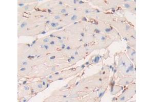 DAB staining on fromalin fixed paraffin- embedded heart tissue) (PLCE1 抗体  (AA 1-250))
