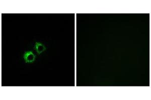 Immunofluorescence analysis of MCF-7 cells, using MRPS21 antibody. (MRPS21 抗体  (Internal Region))