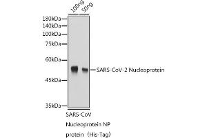 Western blot analysis of Recombinant Nucleoprotein of Coronavirus SARS-CoV-2,using SARS-CoV-2 Nucleoprotein antibody (ABIN7269053) at 1:1000 dilution. (SARS-CoV-2 Envelope 抗体)