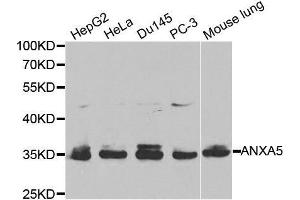 Western blot analysis of extracts of various cell lines, using ANXA5 antibody. (Annexin V 抗体  (AA 1-320))
