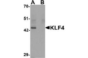 Image no. 1 for anti-Kruppel-Like Factor 4 (Gut) (KLF4) (C-Term) antibody (ABIN1449393) (KLF4 抗体  (C-Term))