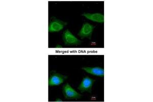 ICC/IF Image Immunofluorescence analysis of paraformaldehyde-fixed HeLa, using TBG, antibody at 1:200 dilution. (SERPINA7 抗体  (Center))