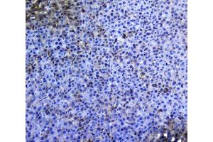 anti-Tumor Necrosis Factor (Ligand) Superfamily, Member 10 (TNFSF10) (AA 40-272) antibody