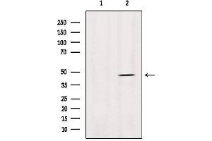 Western blot analysis of extracts from HepG2, using MMP28 Antibody. (MMP28 抗体  (Internal Region))
