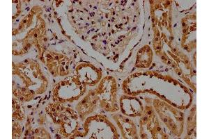 Immunohistochemistry (IHC) image for anti-Glyceraldehyde-3-Phosphate Dehydrogenase (GAPDH) (AA 3-335) antibody (ABIN7153644)