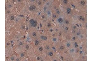 Immunohistochemistry (IHC) image for anti-Glutathione S-Transferase mu 4 (GSTM4) (AA 18-215) antibody (ABIN7439909)