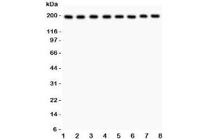 Western blot testing of ZO-1 antibody and Lane 1:  rat liver;  2: mouse liver;  3: (r) NRK;  4: (r) PC12;  5: human HeLa;  6: (h) SMMC-7721;  7: (m) HEPA;  8: (h) COLO320 lysate. (TJP1 抗体  (AA 1178-1527))