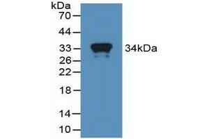 Detection of Recombinant MX1, Human using Polyclonal Antibody to Myxovirus Resistance 1 (MX1) (MX1 抗体  (AA 80-342))