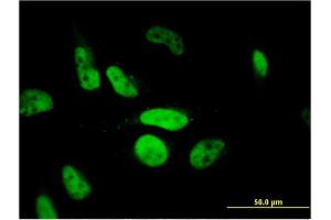 Immunofluorescence of monoclonal antibody to PHF11 on HeLa cell. (PHF11 抗体  (AA 1-292))