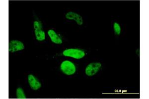 Immunofluorescence of monoclonal antibody to PHF11 on HeLa cell.