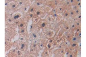 Detection of LOXL2 in Human Liver Tissue using Polyclonal Antibody to Lysyl Oxidase Like Protein 2 (LOXL2) (LOXL2 抗体  (AA 544-751))