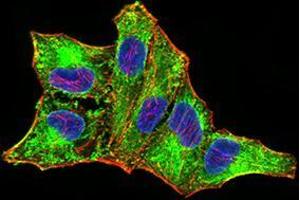 Immunofluorescence analysis of MCF-7 cells using DDX58 mouse mAb (green). (DDX58 抗体  (AA 789-925))