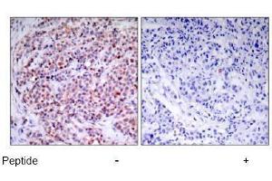 Image no. 1 for anti-Nuclear Factor-kB p65 (NFkBP65) (Thr435) antibody (ABIN197113)