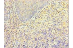 Immunohistochemistry (IHC) image for anti-Transient Receptor Potential Cation Channel, Subfamily M, Member 2 (TRPM2) (AA 1204-1503) antibody (ABIN7172857)