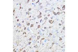 Immunohistochemistry of paraffin-embedded human esophageal using Parvalbumin (Parvalbumin (PVALB)) Rabbit pAb (ABIN6128526, ABIN6146506, ABIN6146507 and ABIN6217573) at dilution of 1:100 (40x lens). (PVALB 抗体  (AA 1-110))