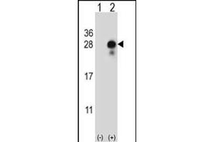 Western blot analysis of DLK2 (arrow) using rabbit polyclonal DLK2 Antibody (C-term) (ABIN652972 and ABIN2842616). (DLK2 抗体  (C-Term))