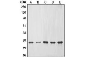 Western blot analysis of ERAS expression in HeLa (A), Jurkat (B), mouse liver (C), PC12 (D), rat kidney (E) whole cell lysates. (ERAS 抗体  (C-Term))