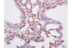 Immunohistochemistry (Paraffin-embedded Sections) (IHC (p)) image for anti-Caspase 3 (CASP3) (AA 11-120) antibody (ABIN747728)