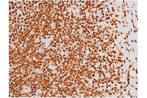 ABIN6267604 at 1/200 staining Human tonsil tissue sections by IHC-P. (c-Rel 抗体  (pSer503))