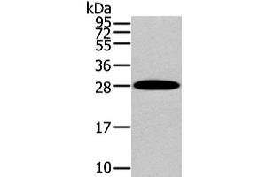 Western Blot analysis of Human liver cancer tissue using ZNF365 Polyclonal Antibody at dilution of 1/200 (ZNF365 抗体)