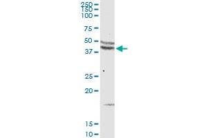 CCR5 MaxPab rabbit polyclonal antibody. (CCR5 抗体  (AA 1-352))