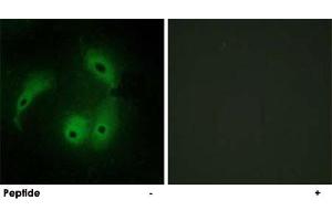 Immunofluorescence analysis of HeLa cells, using AKAP14 polyclonal antibody . (AKAP14 抗体)