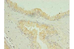 Immunohistochemistry (IHC) image for anti-Solute Carrier Family 34 (Sodium Phosphate), Member 2 (SLC34A2) (AA 574-689) antibody (ABIN7169990)