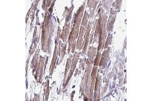 Immunohistochemical staining (Formalin-fixed paraffin-embedded sections) of human heart muscle with CD1E polyclonal antibody  shows moderate to strong cytoplasmic positivity in myocytes. (CD1e 抗体  (AA 79-147))