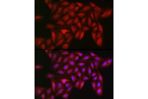 Immunofluorescence analysis of U2OS cells using LDHA Rabbit mAb  at dilution of 1:100 (40x lens). (Lactate Dehydrogenase A 抗体)