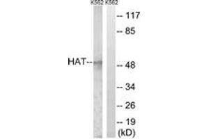 Western Blotting (WB) image for anti-Histone Acetyltransferase 1 (HAT1) (AA 331-380) antibody (ABIN2889272) (HAT1 抗体  (AA 331-380))