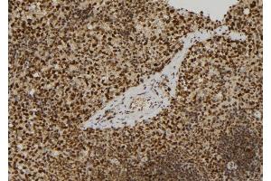 ABIN6279722 at 1/100 staining Mouse spleen tissue by IHC-P. (RERG 抗体  (Internal Region))