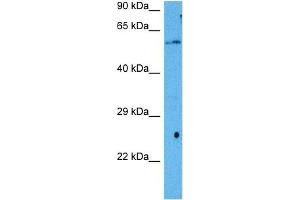 Host:  Mouse  Target Name:  RORA  Sample Tissue:  Mouse Liver  Antibody Dilution:  1ug/ml (RORA 抗体  (Middle Region))