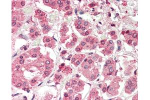 Human, Adrenal: Formalin-Fixed Paraffin-Embedded (FFPE). (PBX2 抗体  (N-Term))