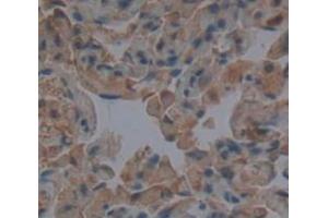 Used in DAB staining on fromalin fixed paraffin- embedded Kidney tissue (TUBD1 抗体  (AA 190-453))