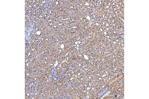 IHC analysis of TRMT61A using anti-TRMT61A antibody (ABIN7599220).