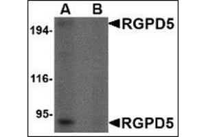 Western blot analysis of RGPD5 in human thymus tissue lysate with this product at 1 μg/ml in (A) the absence and (B) the presense of blocking peptide. (RGPD5 / RGPD6 (Center) 抗体)